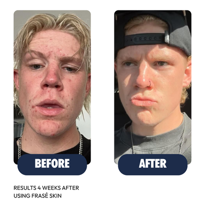 Daily Facial Cleanser