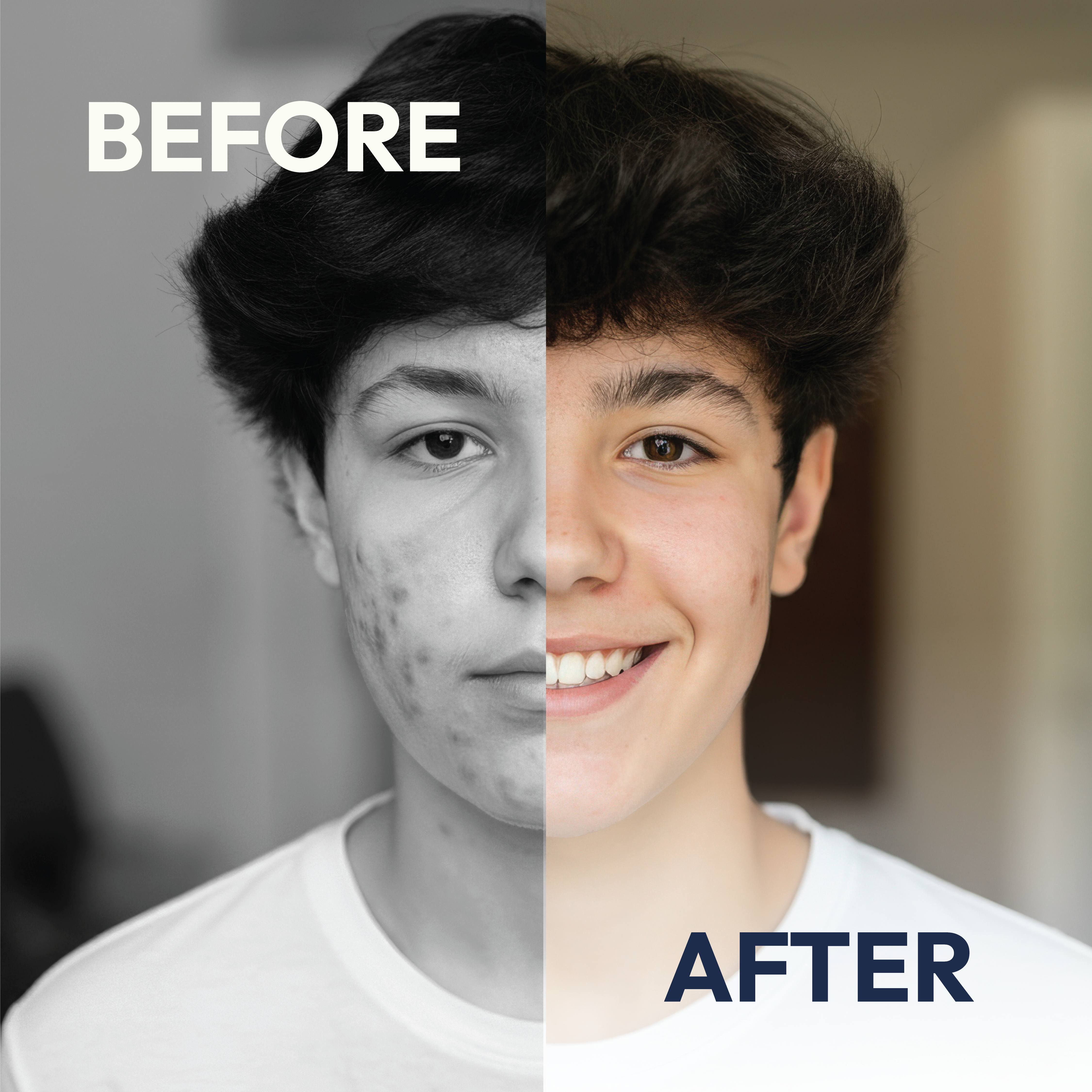 His Redness Started to Calm Down