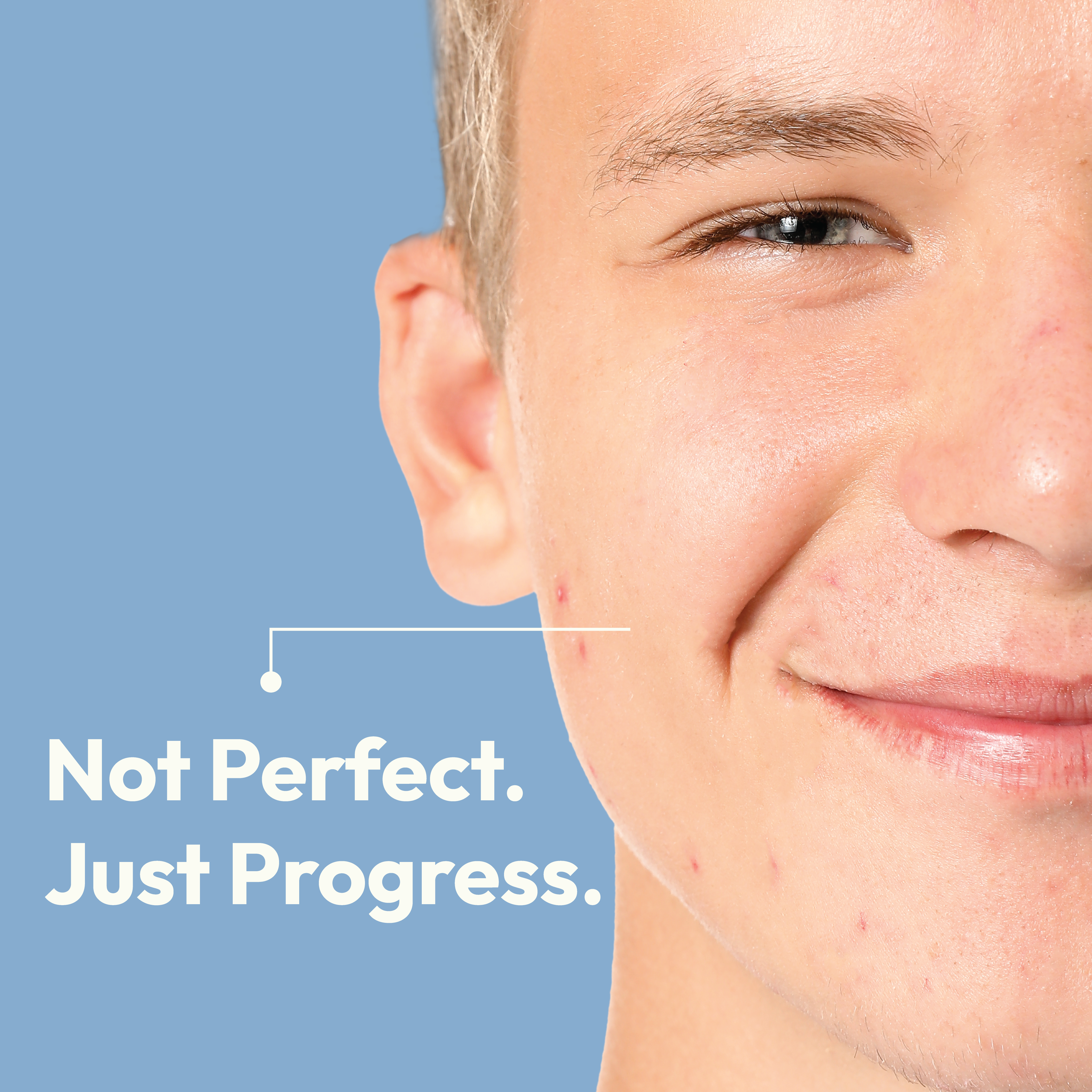 The Breakouts Slowed